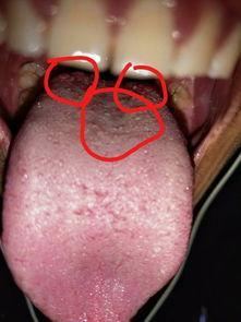 吃瓜舌头根划破,吃瓜舌头根划破的奇妙体验